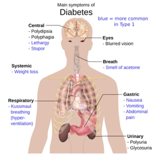 Clinical Validation – Diabetic Ketoacidosis (DKA) Blog Picture 4