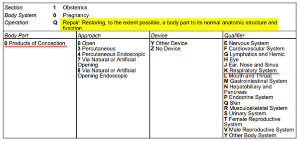 ICD-10-PCS Coding for Ex Utero Intrapartum (EXIT) Procedures