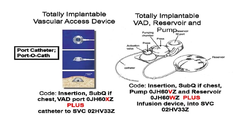 Totally Implantable Port with VAD/ Reservoir with Pump and VAD