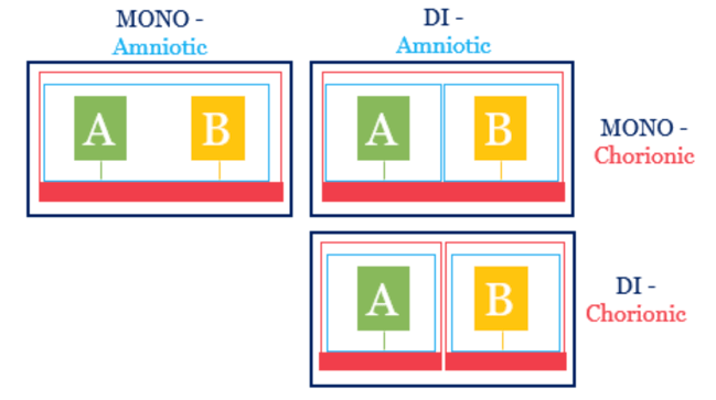 Monochorionic monoamniotic (MoMo) Image