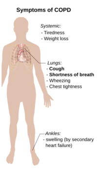 Symptoms of COPD