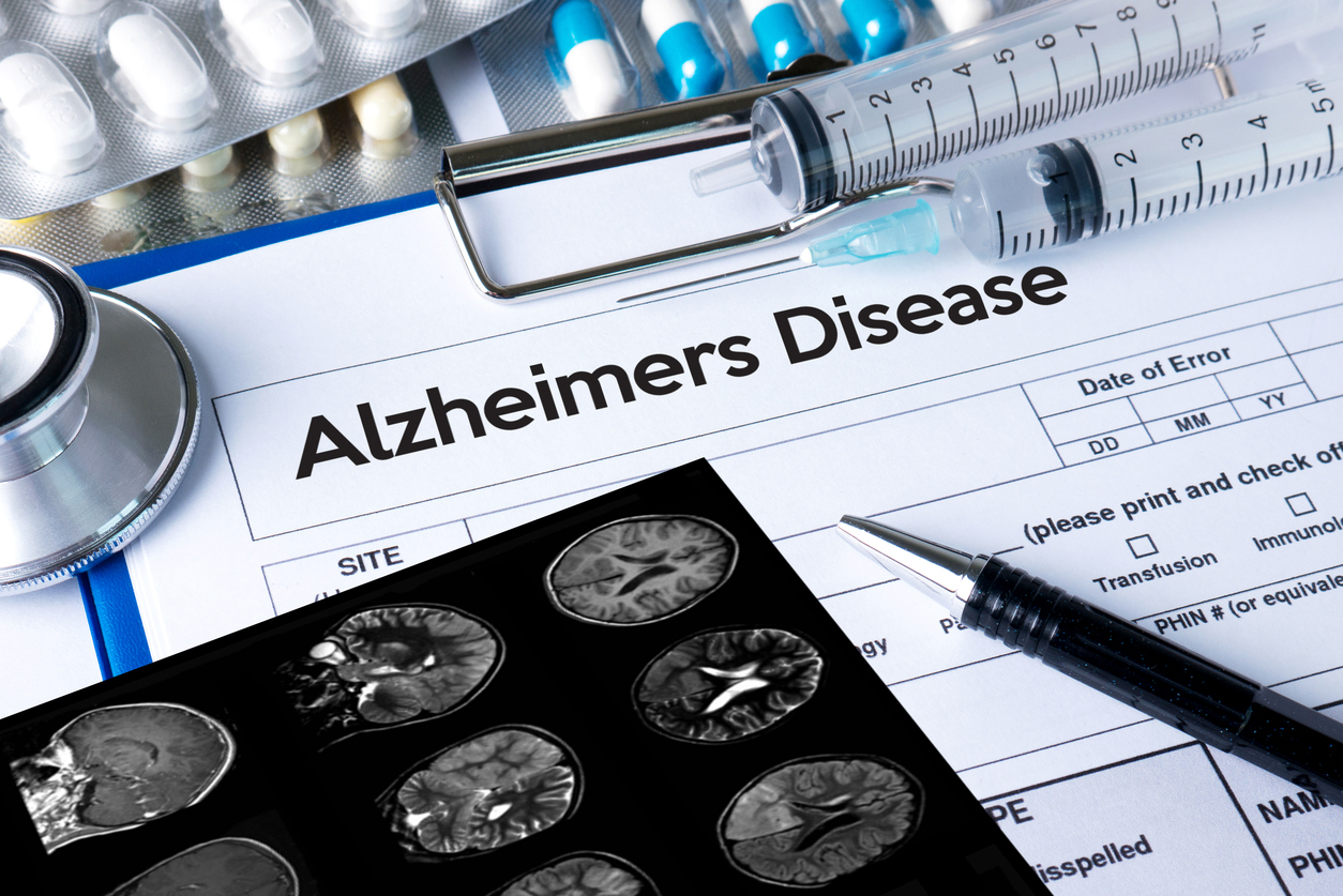 Coding Tip: Defining and Coding Alzheimer's Disease