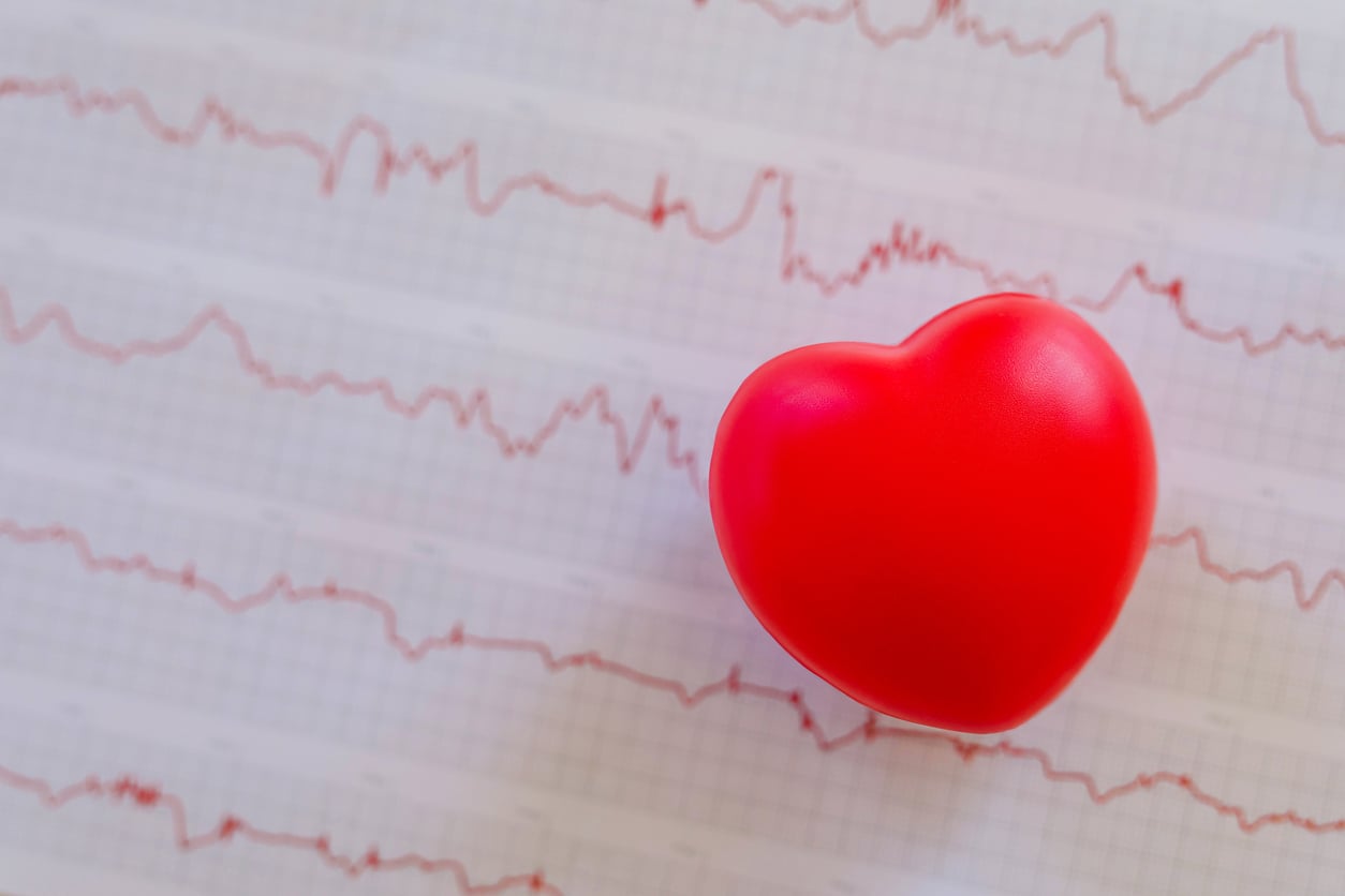 Atrial Fibrillation (AFib): What CDI Professionals Need to Know