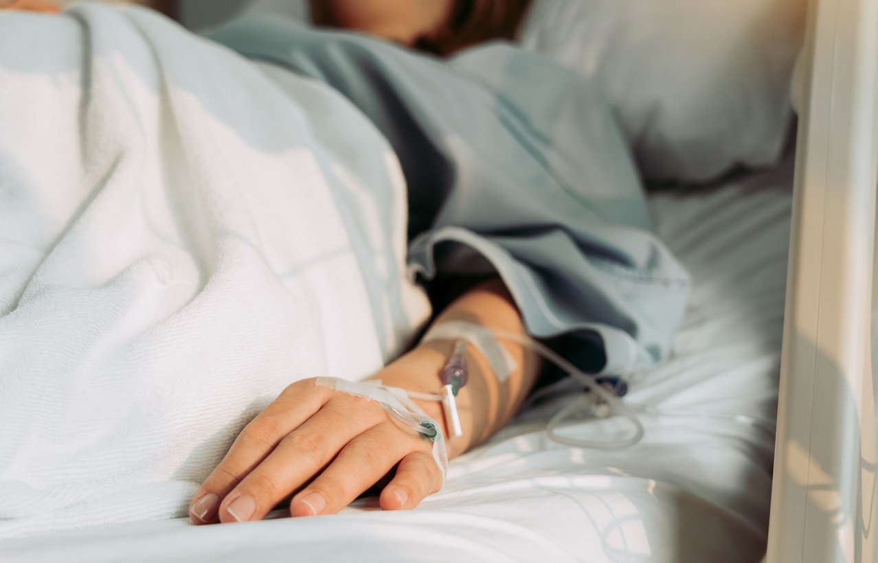 Querying for Sepsis: How to Identify Clinical Indicators and Avoid Leading Language