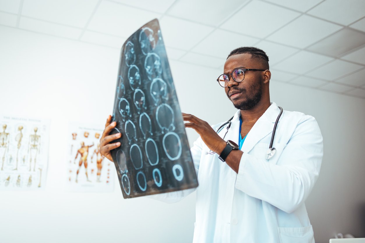 Cerebral Edema as a Clinically Significant Diagnosis