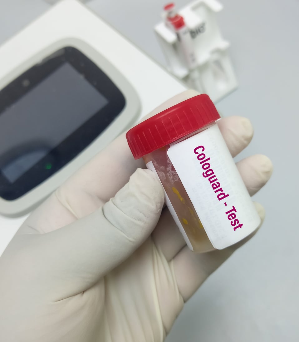 ICD-10-CM Coding for Colonoscopy Following Positive Cologuard Result