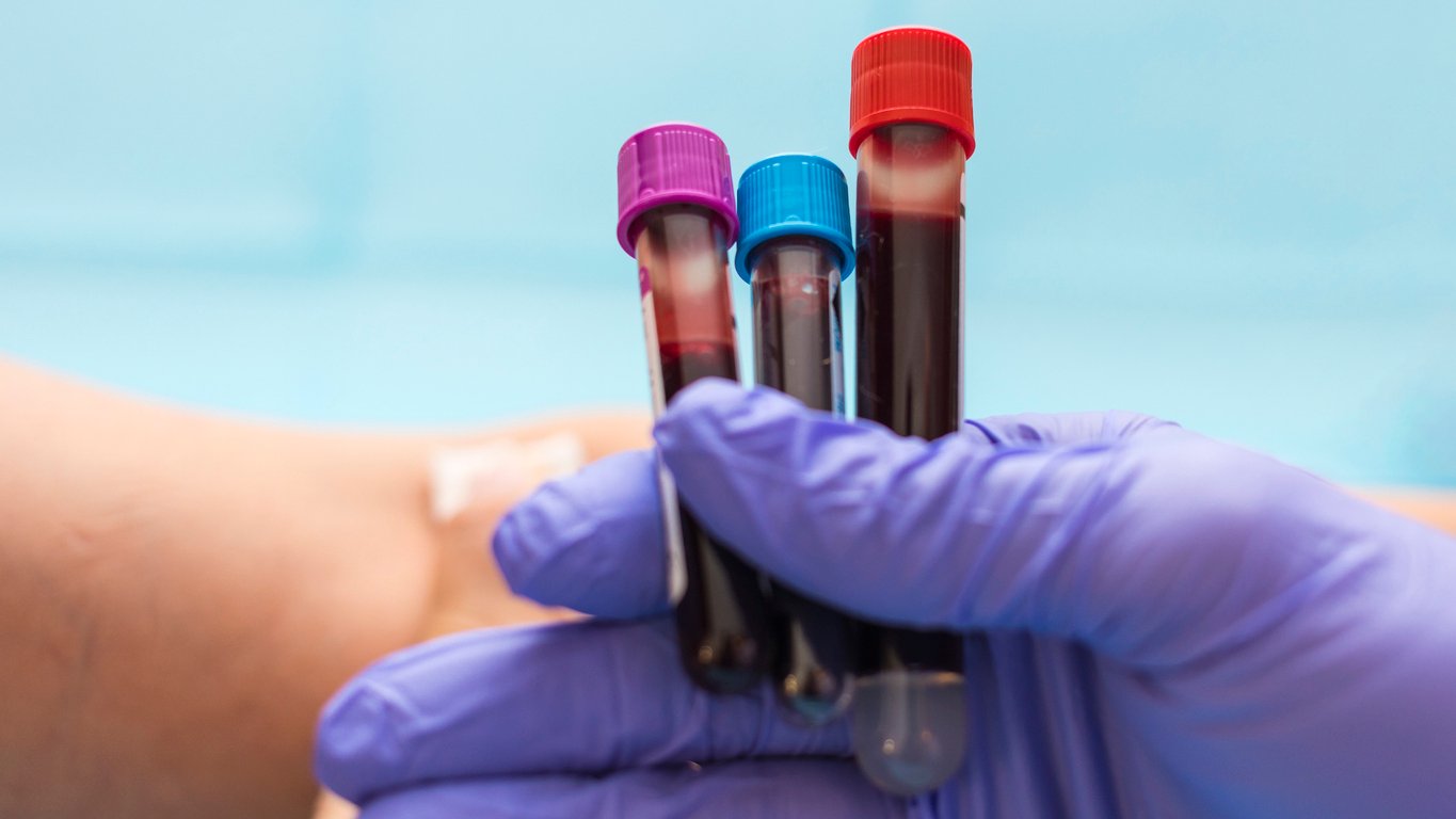 Anemia Query Best Practices