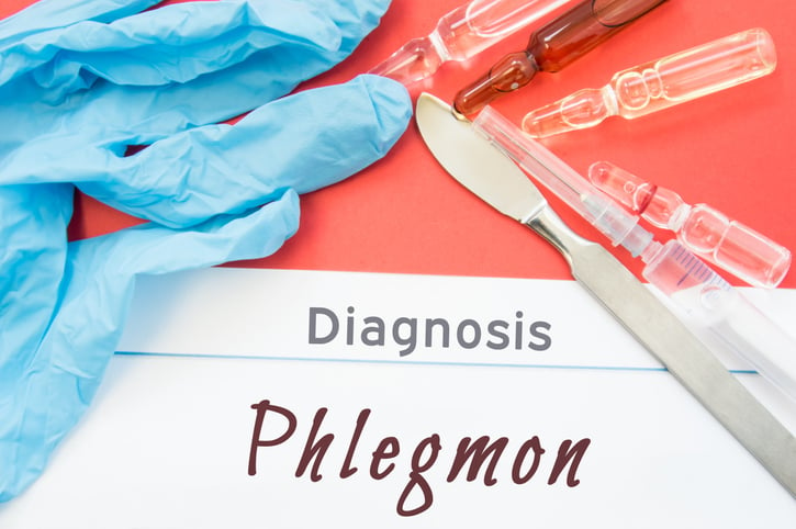 Coding the Diagnosis of Phlegmon Impacts DRG and SOI